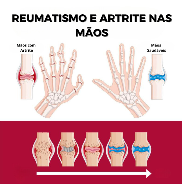 FlexiDerm Creme Restaurador