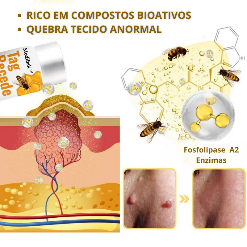 Spray removedor de Verrugas - BeeClean